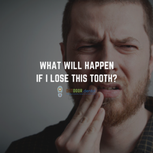what will happen if i lose this tooth blog header