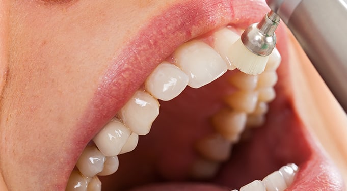 Dental exams are important to maintaining healthy teeth