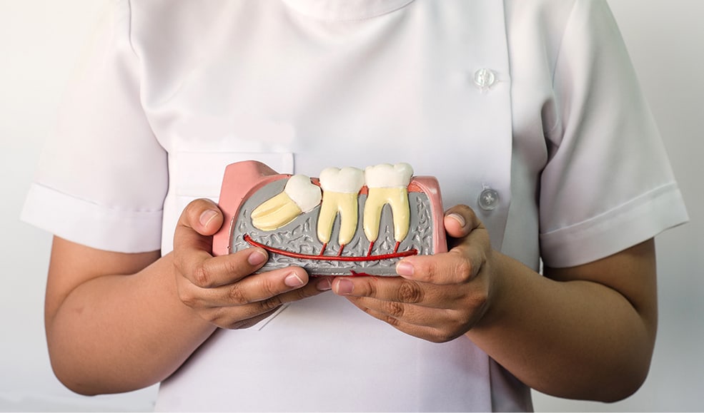 A dentist holds up a plastic model of what impacted wisdom teeth may look like in someone's jaw