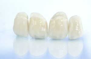 A set of dental crowns against a white background.