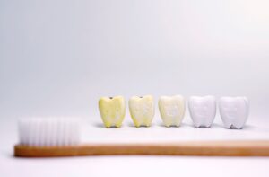 A set of teeth sit facing a toothbrush, half of the teeth are white, while the other half are slightly yellowed.